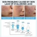 Hyaluronic Acid Face Serum Anti-Aging Shrink Pore Whitening Moisturizing Face Cream Dry Skin Care - Image 3